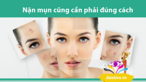 nặn mụn đúng cách, nặn mụn trứng cá,
